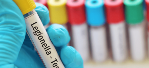 Curso oficial Certificado de Prevención de la Legionella y la Legionelosis