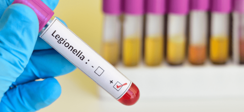 Renovación certificado Legionella