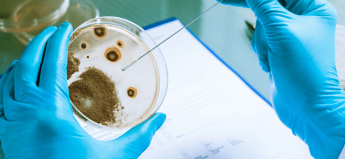 Listeria_ Prevención y control en la industria alimentaria